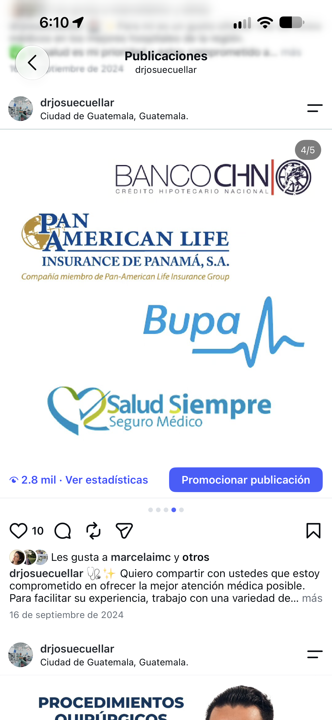 Bupa